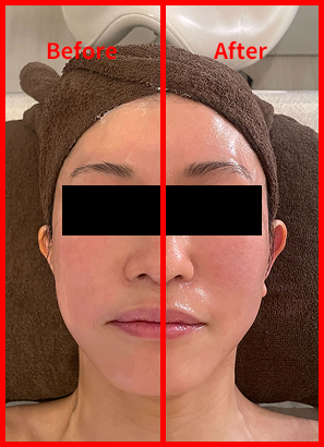 Before-After_40歳女性